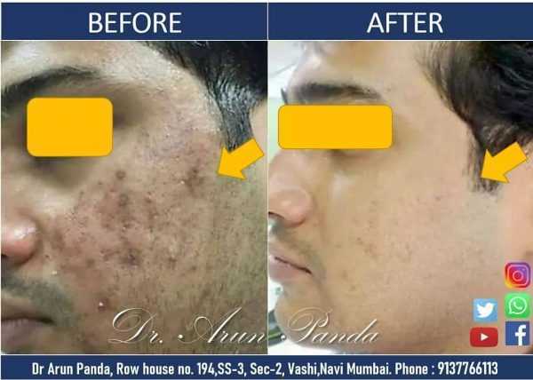 Bodyskulpt Aesthetics - 1