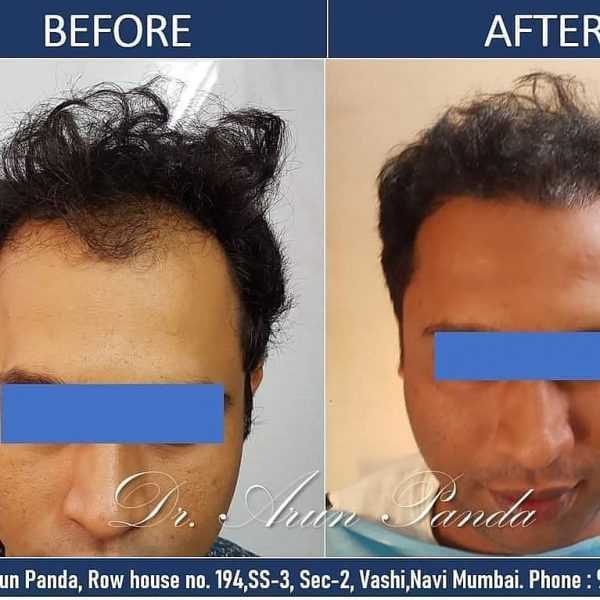 Bodyskulpt Aesthetics - 3