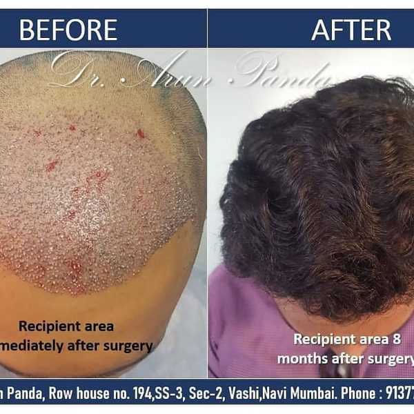 Bodyskulpt Aesthetics - 6