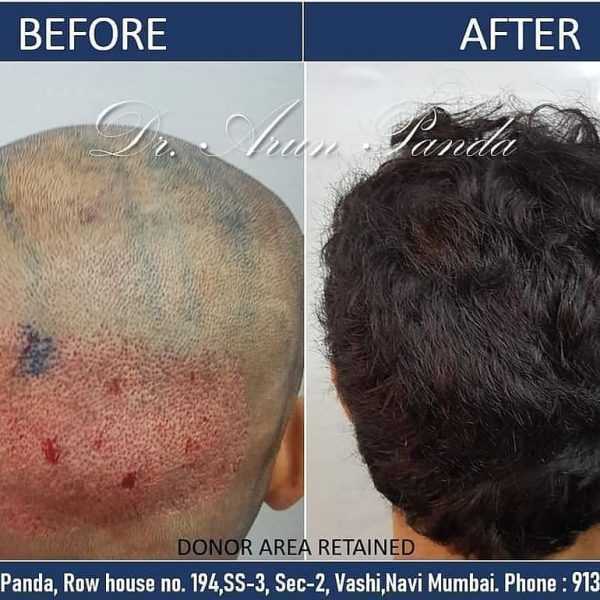 Bodyskulpt Aesthetics - 5