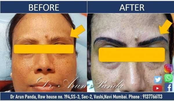 Bodyskulpt Aesthetics - 7